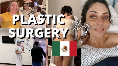 Tummy Tuck in Tijuana, Mexico • Check Prices & Reviews